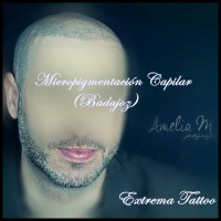 /album/micropigmentacion/tricopigmentacion-capilar-badajoz-x1-1-jpg/